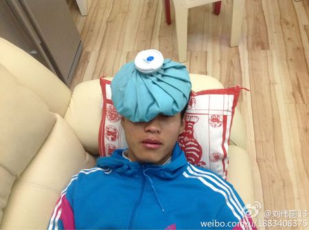 训练中鼻梁骨骨折啦,真是无语啦