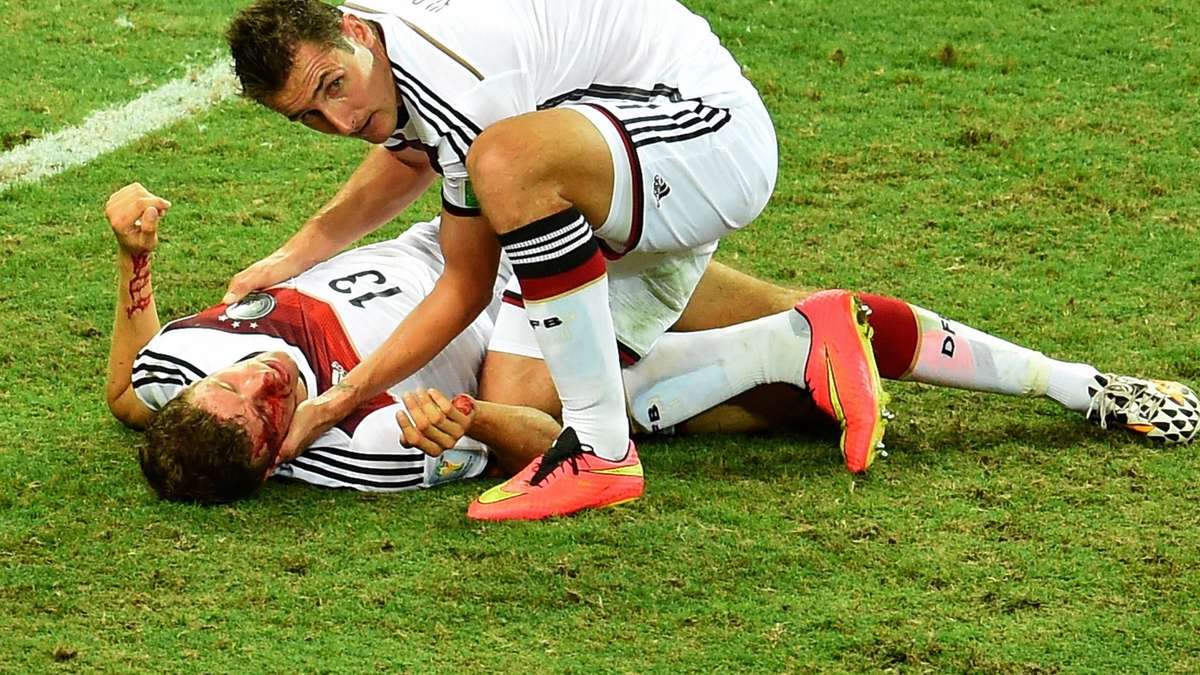 博阿滕受伤仍需检查，穆勒眉骨撞出血_虎扑国际足球新声