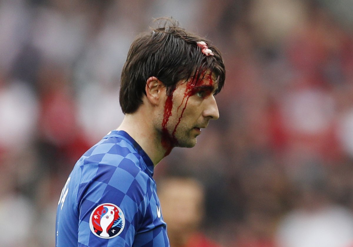 克罗地亚拼命三郎!乔尔卢卡血染球场_虎扑国际