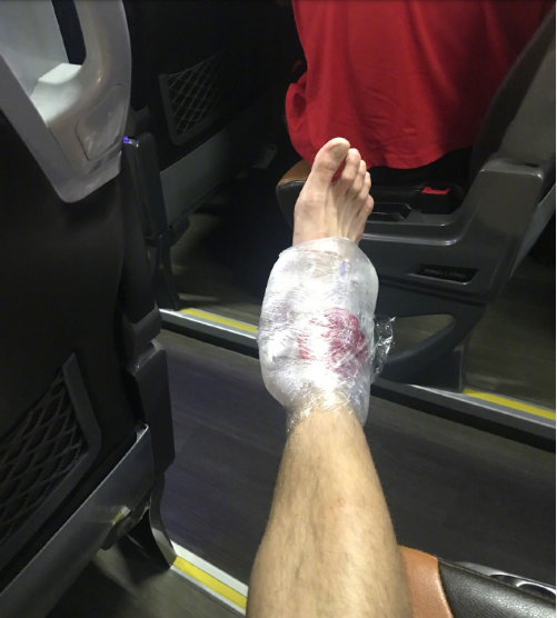 郭艾伦晒冰敷照:好多年没扭伤了,应该问题不大