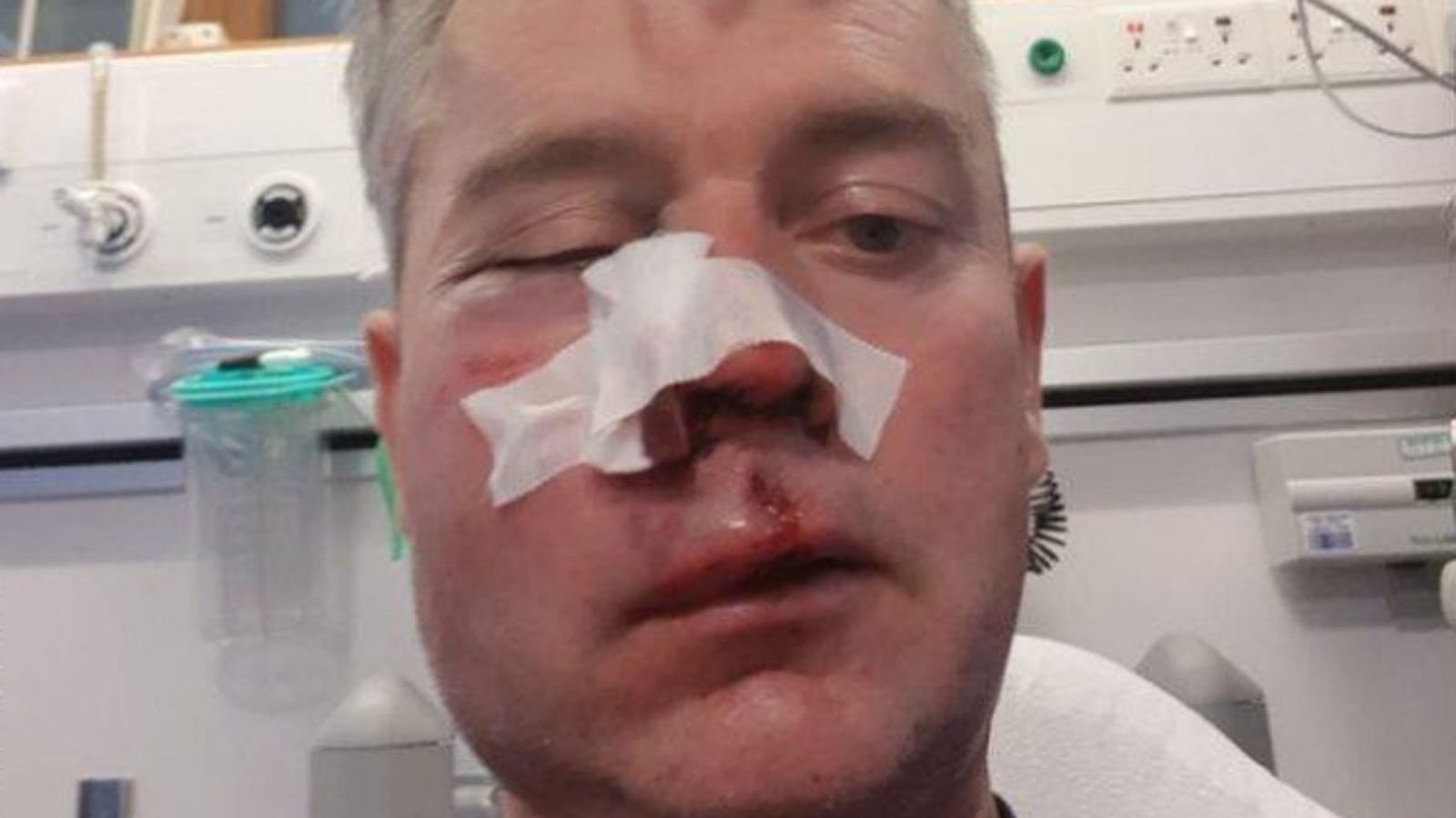 爱尔兰一裁判赛后遭到球员球迷群殴致颌骨骨折
